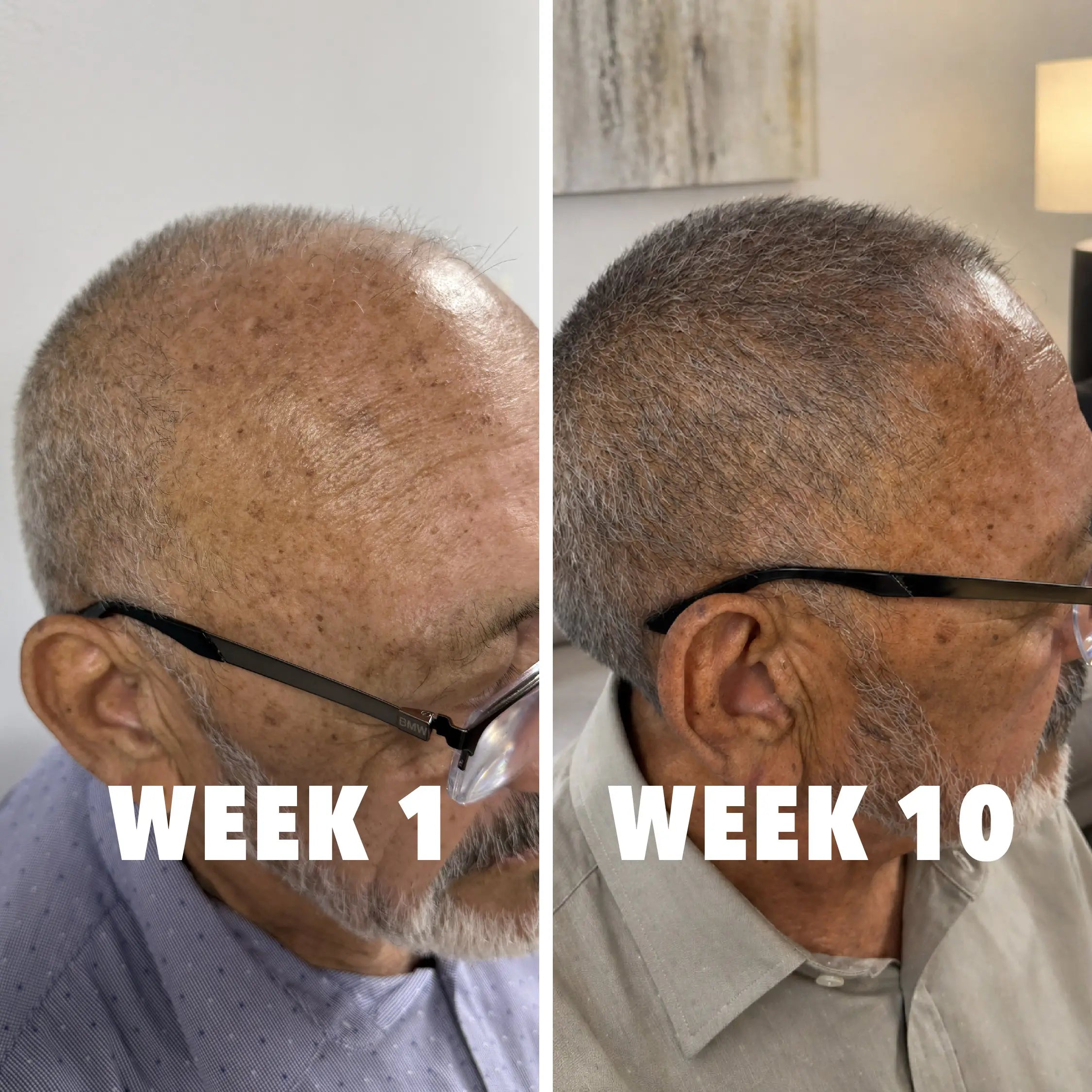 Castor Oil + Biotin Shampoo Bar - HAIR GROWTH